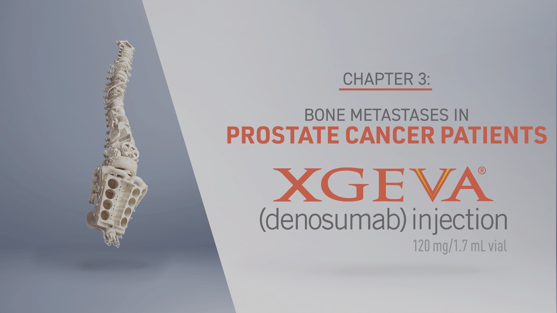 Chapter one: Watch a video about how Dr. Berenson uses XGEVA® with his Multiple Myeloma Patients